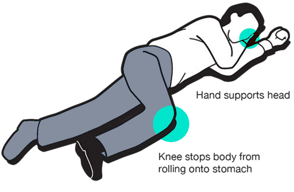 The Recovery Position: Hand Supports Head and Knee Stops Body Roll