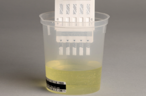 Methadone Test Put in Urine Cup