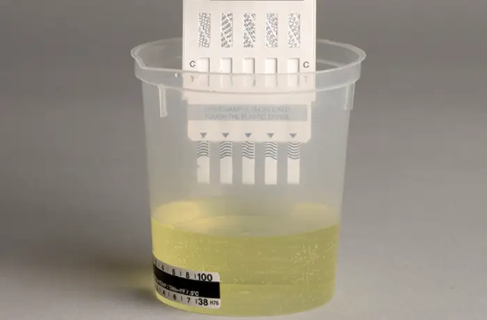 Will Methadone Show On Your Drug Test? (Maybe) » Symetria Recovery 