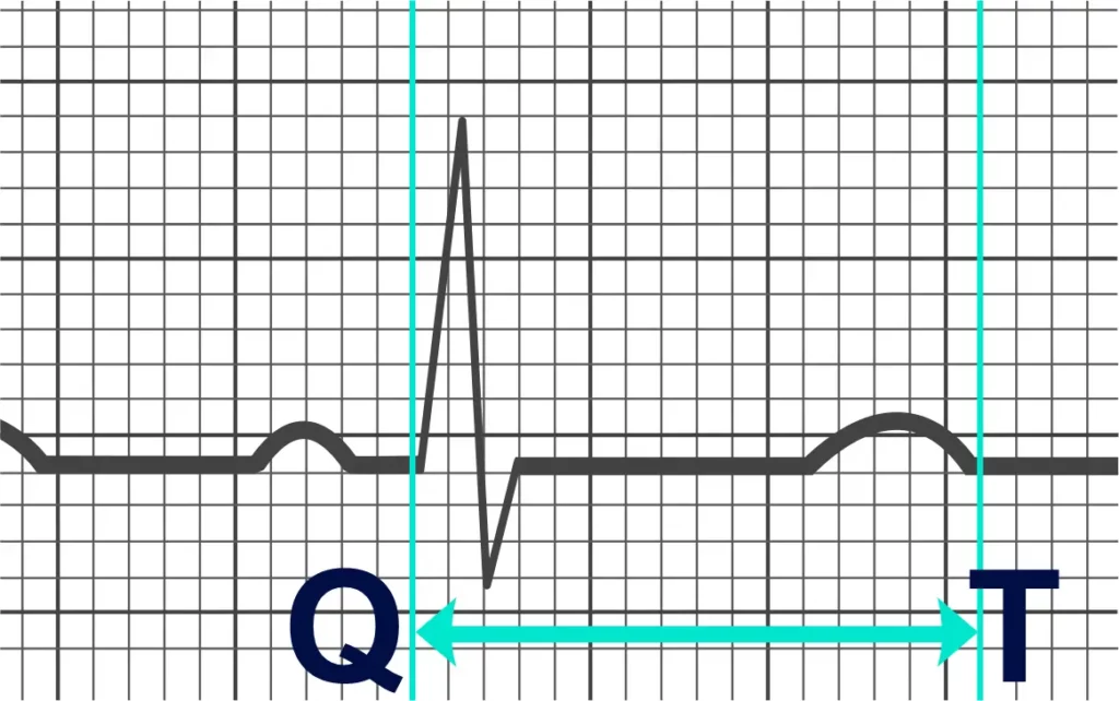 Long QT EGK Example