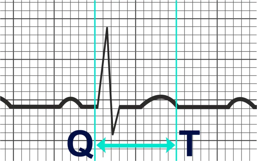 Long QT EGK Example