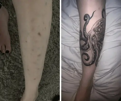 Track Marks Covered By Black Tattoo