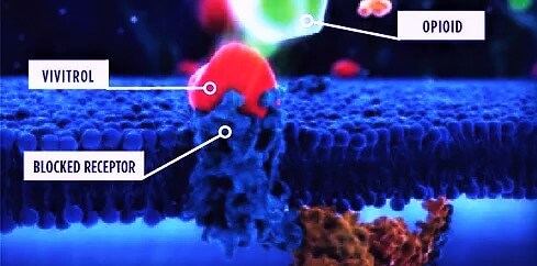 Vivitrol blocking opioids in the brain
